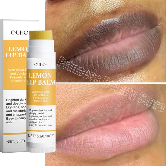 Turmeric Lip Balm – Dark Lip Lightening & Deep Moisturizing Care