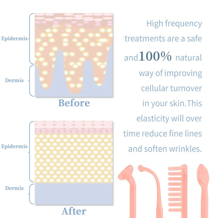 4-in-1 High Frequency Facial Wand